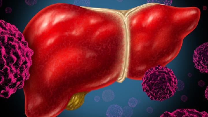 肝纤维化四项助肝病患者预防肝硬化