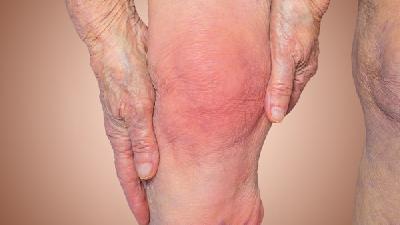 女性经期用冷水洗脚可诱发类风湿关节炎