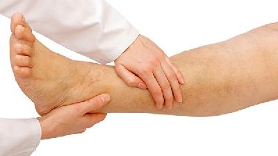 O型腿可导致膝关节炎