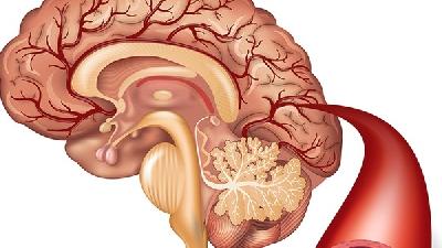 脑癌患者颅内压增高时的眼部变化