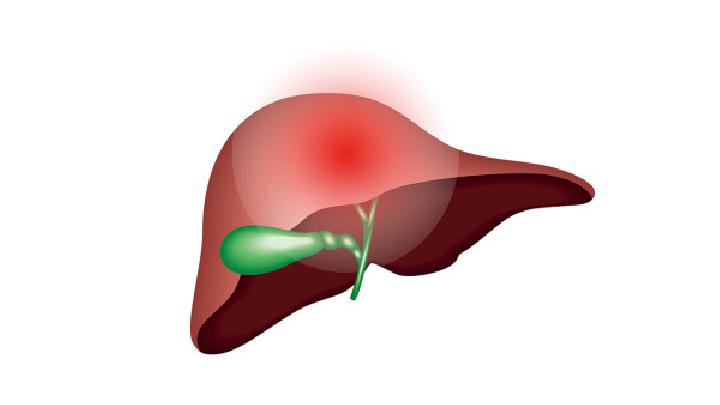 原发性胆汁性肝硬化病理分期可分4阶段