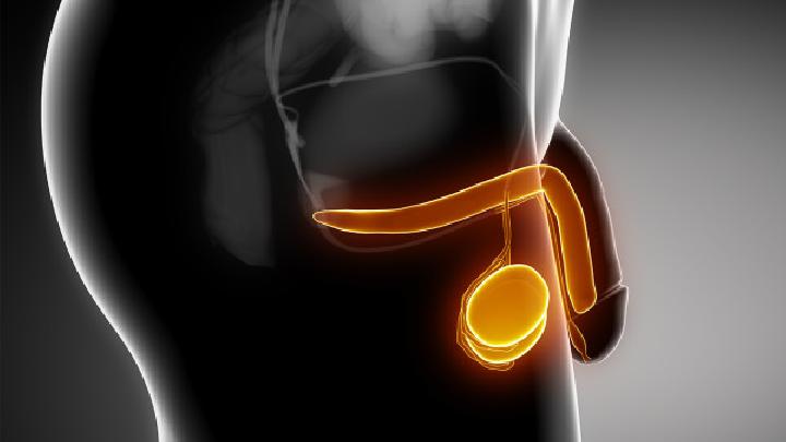 7%前列腺炎患者可引发无精症