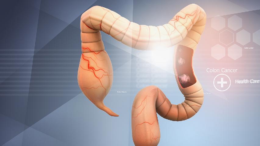 疑似大肠癌者可做纤维结肠镜检查