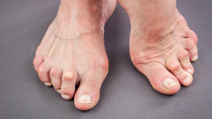 骨質(zhì)增生中醫(yī)分型不同特點(diǎn)