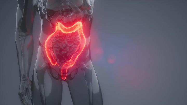 5种回肠袋吻合术可用于治疗结肠炎