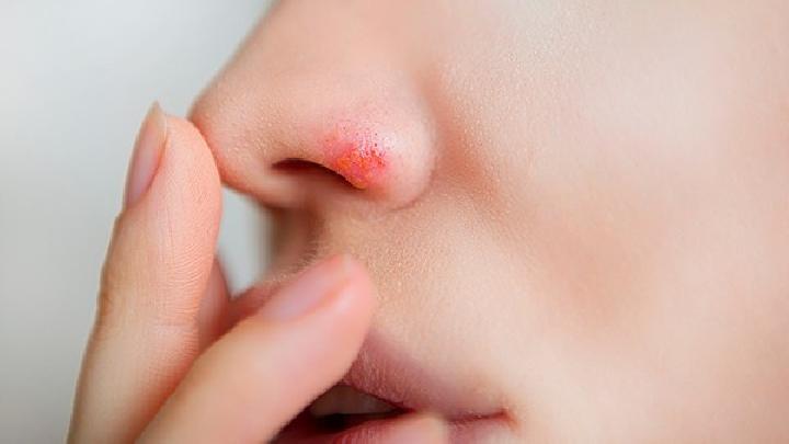萎缩性鼻炎的中医辨证治疗