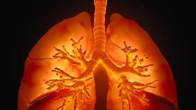 如何鉴别细菌性肺炎和急性肺脓肿