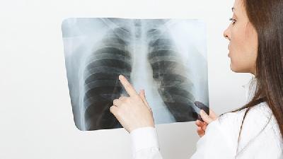 诊断肺癌可以做胸部X线检查
