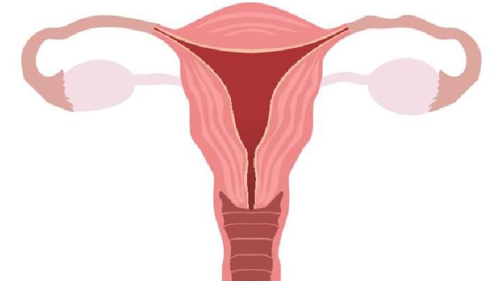未婚未育的女性也可能患上卵巢癌