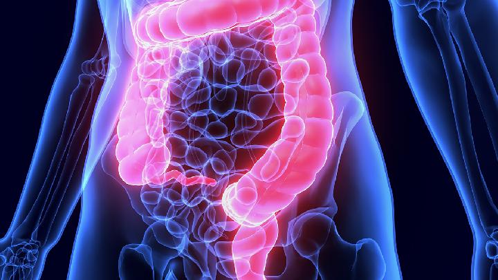 不同部位大肠癌引起的肠梗阻有何表现?