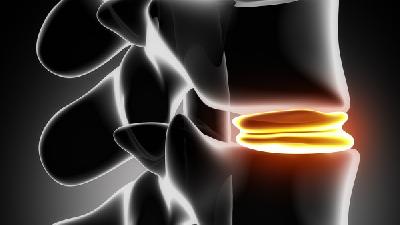 强直性脊柱炎有哪些特点？