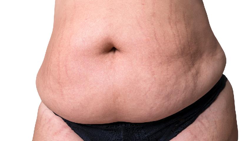 专家讲解容易招惹痤疮的几种习惯