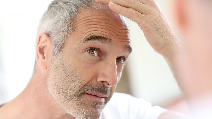 生活中通常会出现怎样的脂溢性脱发的症状
