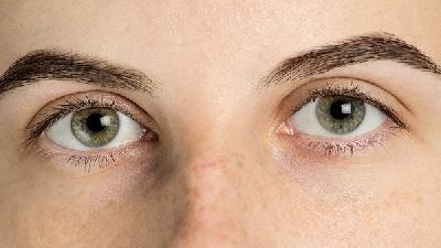 春季如何预防痤疮