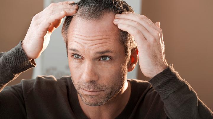 预防脂溢性脱发应学会正确洗头