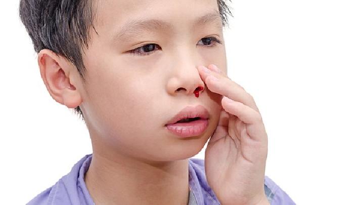 鼻中隔血肿和脓肿有哪些症状