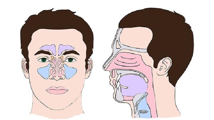 鼻窦炎疾病常见的七种症状表现
