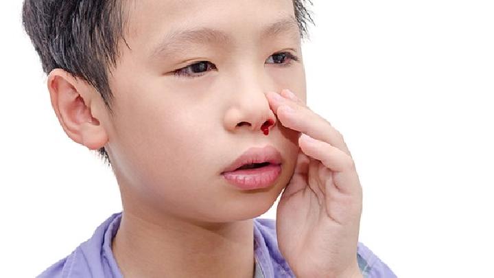 鼻中隔血肿可以并发哪些疾病？