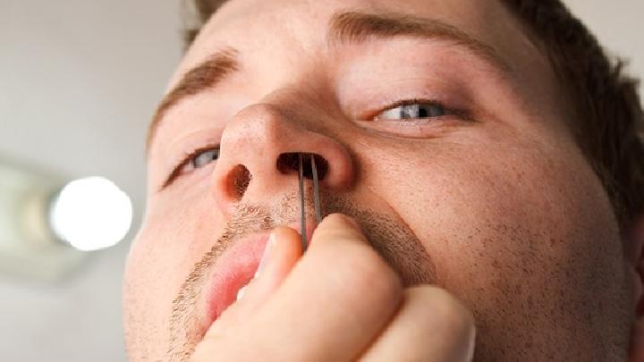过敏性鼻炎患者如何护理