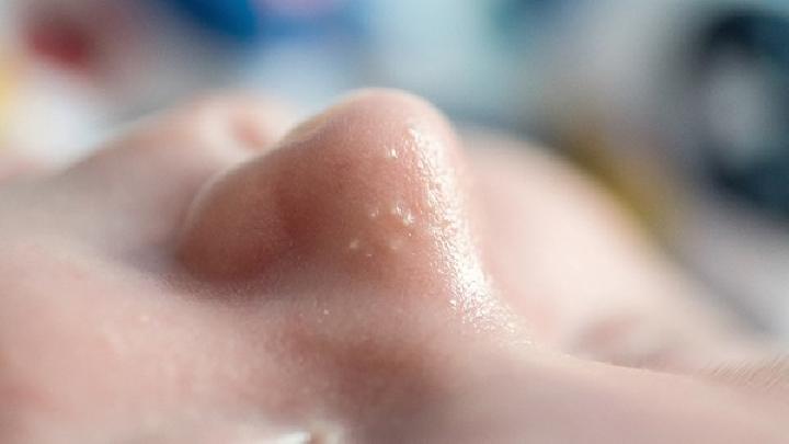怀孕期间患上鼻炎怎么办