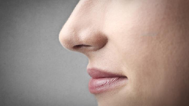 常见的引起鼻出血的原因有哪些
