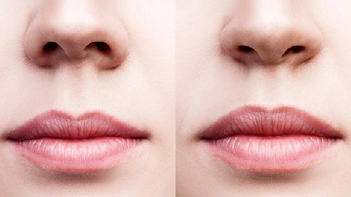 预防急性鼻炎的办法有哪些