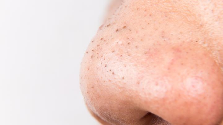 鼻中隔偏曲是由什么原因引起的？