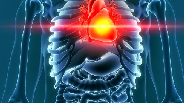 心脏脂肪瘤的发病机制