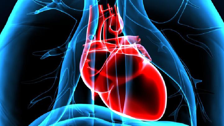 心脏脂肪瘤是什么?