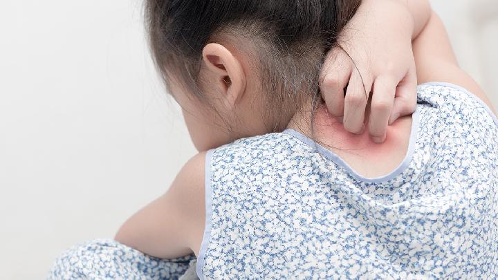 导致小孩出现荨麻疹的原因有哪些?