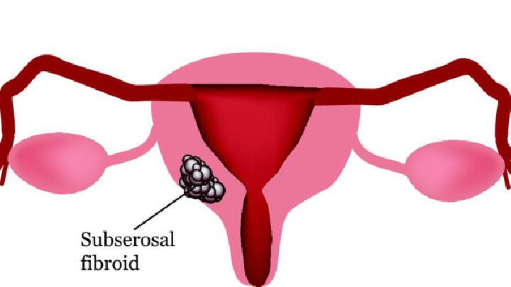 就子宫肌瘤可能存在的危害介绍