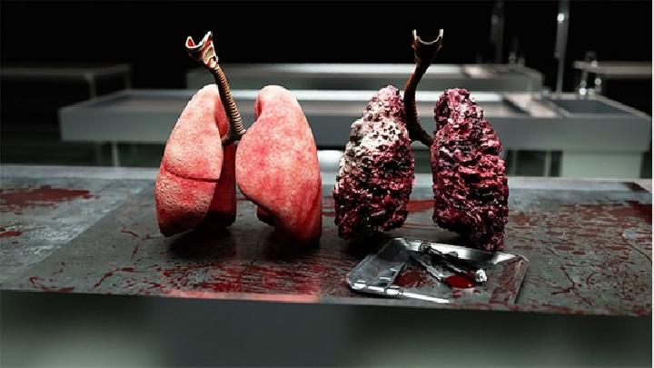 肺肿瘤怎样进行饮食调理