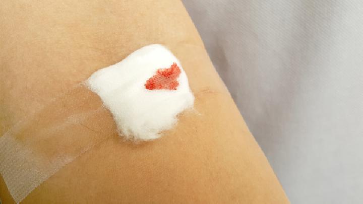 红色胎记是不是没有能治好的，伤疤有好的治疗办法吗