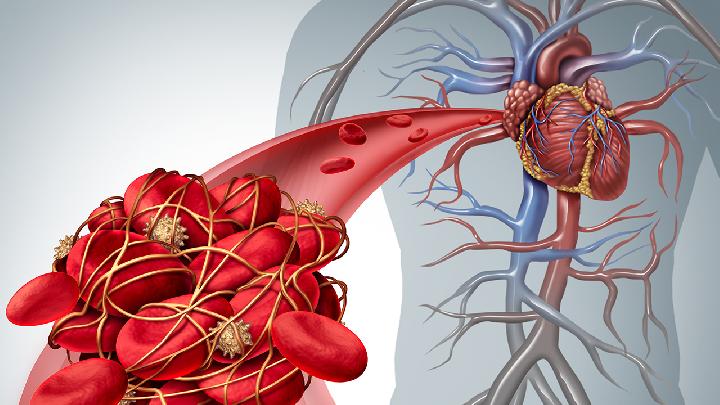心血管疾病会带来什么其他的病？