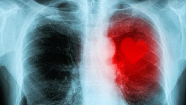 如何诊断矽肺？
