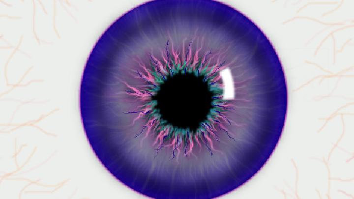 眼假组织胞质菌病综合症怎么治疗