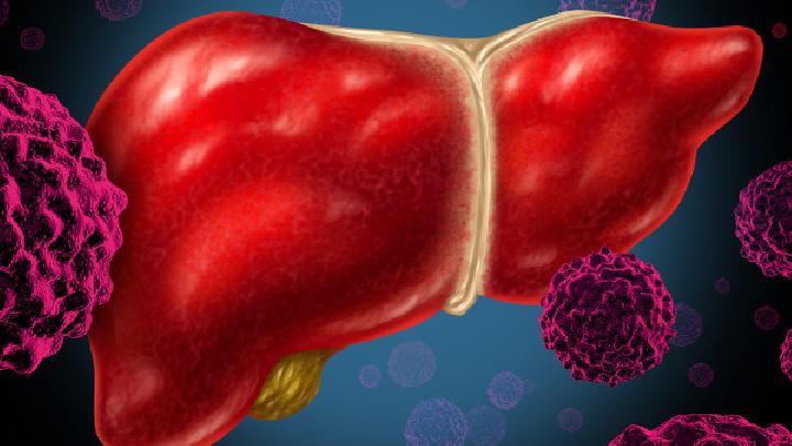 肝硬化要注意什么呢