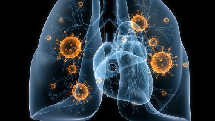 肺曲菌病有哪些症状？