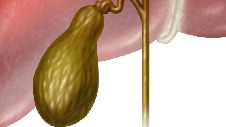 胆结石引发急性胰腺炎康复后的问题