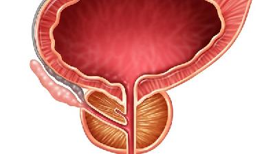 男性应该怎么预防前列腺疾病 男性预防前列腺疾病常识介绍