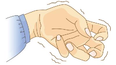 讀完這些，讓您真正了解羊角風(fēng)中醫(yī)治療的優(yōu)勢