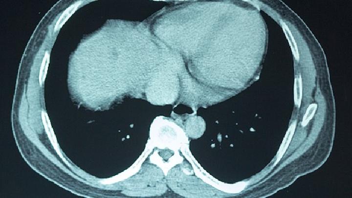 三點詳解新生兒先天性腦癱病因