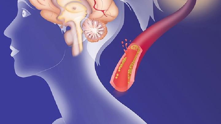 年輕外傷性腦癱病因