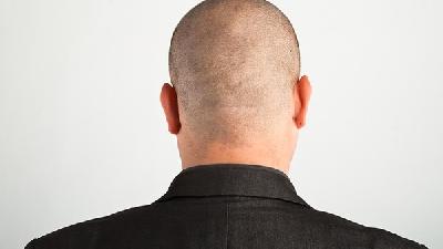 男人腦癱藥物治療