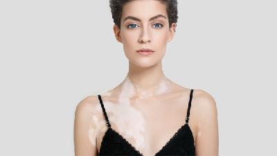 引起黄褐斑原因有什么