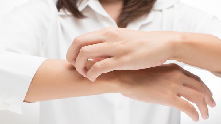 女人黃褐斑的內(nèi)調(diào)偏方