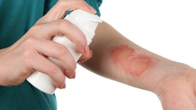 得了黄褐斑的原因有什么