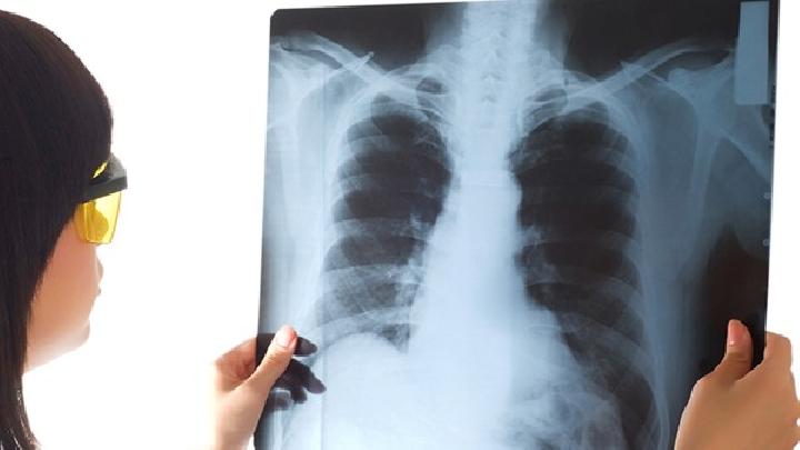 肺气肿的症状是什么