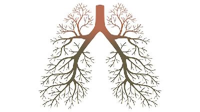 间质性肺气肿遗传吗