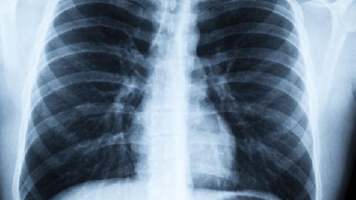 肺间质肺纤维化有哪些症状